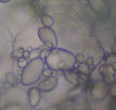 Amyloplast - Wikipedia, the free encyclopedia