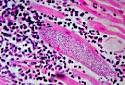 <b>Mycobacterium Leprae</b> | Publish