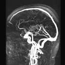 angiografi (<b>kärlröntgen</b>)