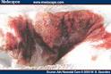 A Critical Analysis of the Routine Testing of Newborn Stools: The ...