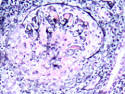 Levy: <b>Anti</b>-<b>Glomerular Basement</b>