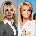 Hit da Wall | Celebrities get ugly | Page 2