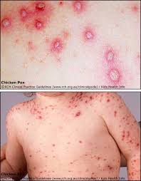 babies diseases
