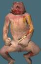 Pediatric Pathology