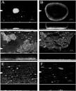 Opportunistic <b>Infections</b> Caused by <b>Serratia</b> marcescens - MicrobeWiki