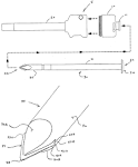Trocar - NeoSurg Technologies, Inc.