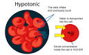 SPM Biology: Types of Solution - Hypotonic
