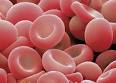 La <b>talasemia</b> beta ocurre