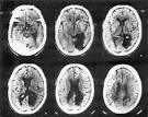CAT Scans - Math Central