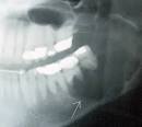 unusual x rays