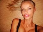 Girls With Silicone Lips