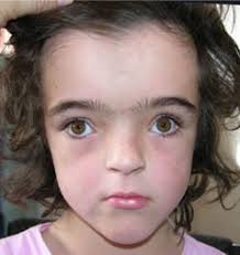 Шокирующая правда про Аватар, или Истинный диагноз На'Ви 