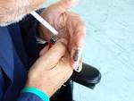 <b>Thromboangiitis Obliterans</b>