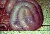 Los expertos opinan : Colitis: <b>disentería</b> y espiroquetosis