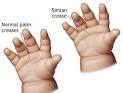 The Simian Line