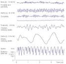 13. Electroencephalography