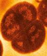 The World's Toughest Bacterium