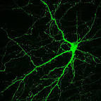 Scientists transplant neural stem cells from a monkey's skin into ...