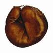 Encyclopedia of Baseball Catcher's Equipment - Mitt