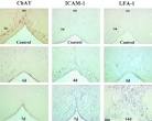 ScienceDirect.com - Brain Research - Sequential upregulation of