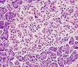<b>Islotes pancreáticos</b>