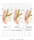 <b>Sphincter</b> of <b>Oddi Dysfunction</b>