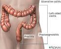 DIGESTIVE DISEASE CENTER - University of Texas Health Science ...