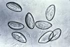 File:Eggs of <b>Enterobius</b>