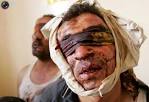 War in Iraq 2003 2011 in