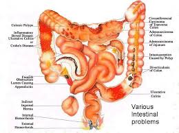Colon Health