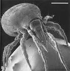 Dust Mites: Everything You Might Not Want To Know!!!