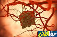 Image result for ‫رگ‏زايي (Angiogenesis) در تومور‬‎