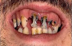 http://t3.gstatic.com/images?q=tbn:ANd9GcSLFEJdWO6y68d4YRkRVs0olllQGZ8bRCcXkwVvCBWx_VL3gr_E