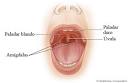 <b>Paladar</b> duro y <b>blando</b> - [Hard