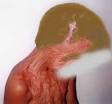 How the hell does this work   Blood