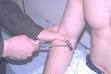 The Precise Neurological Exam