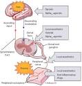 New Concepts In Acute Pain Therapy: Preemptive Analgesia - May 15 ...
