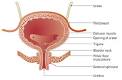 Bladder infections - symptoms, causes, diagnosis and treatment by ...
