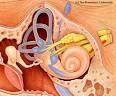Meniere's Disease