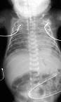 Other Abdominal Films