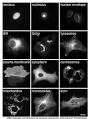 Cytoplasm - Wikipedia, the free encyclopedia