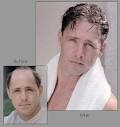 Beauty Tips &amp; Personal Health Care: Hair baldness treatment