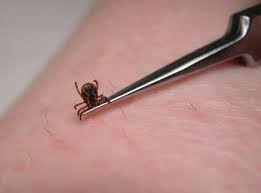 images?q=tbn:ANd9GcSQ-XV6o7sWk5oLzvdhWUIf7cv_GQHo4w1WJaqhIG85cIHKHbrX