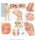 <b>Reiter's Syndrome</b> - Netter Medical Images