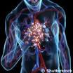 European Commission : CORDIS : Newsroom : Scientists find link