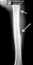 Welcome to LearningRadiology - radiology, radiologic, imaging ...