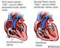 Heart beat - Heart palpitations Pictures &amp; Images (Heartbeat ...