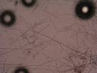 note the tridate spicules,