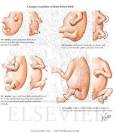Embryology: Limb Bud Rotation - Netter Medical Images