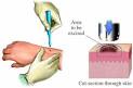 <b>Biopsia</b> por raspado - se